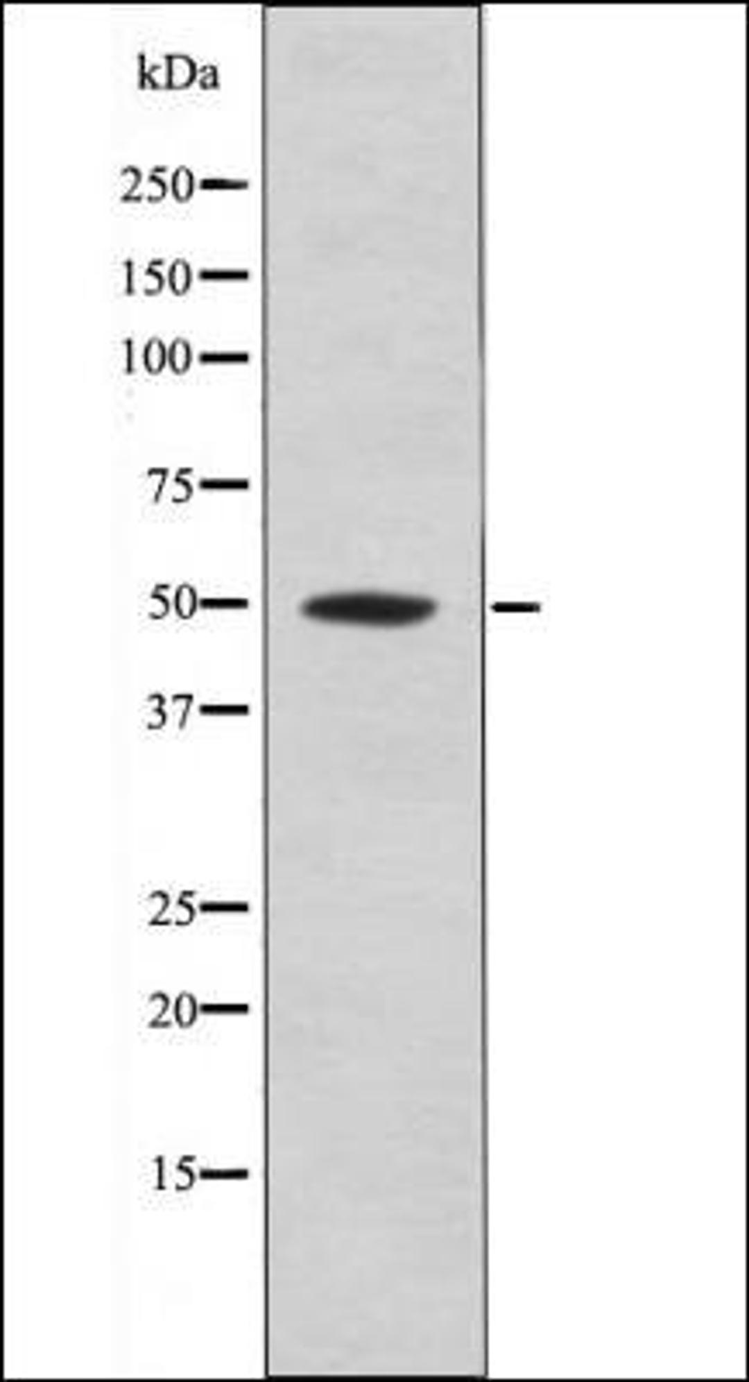 Western blot analysis of Mouse braintissue lysates using MOK -Phospho-Tyr161- antibody