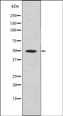 Western blot analysis of Mouse braintissue lysates using MOK -Phospho-Tyr161- antibody