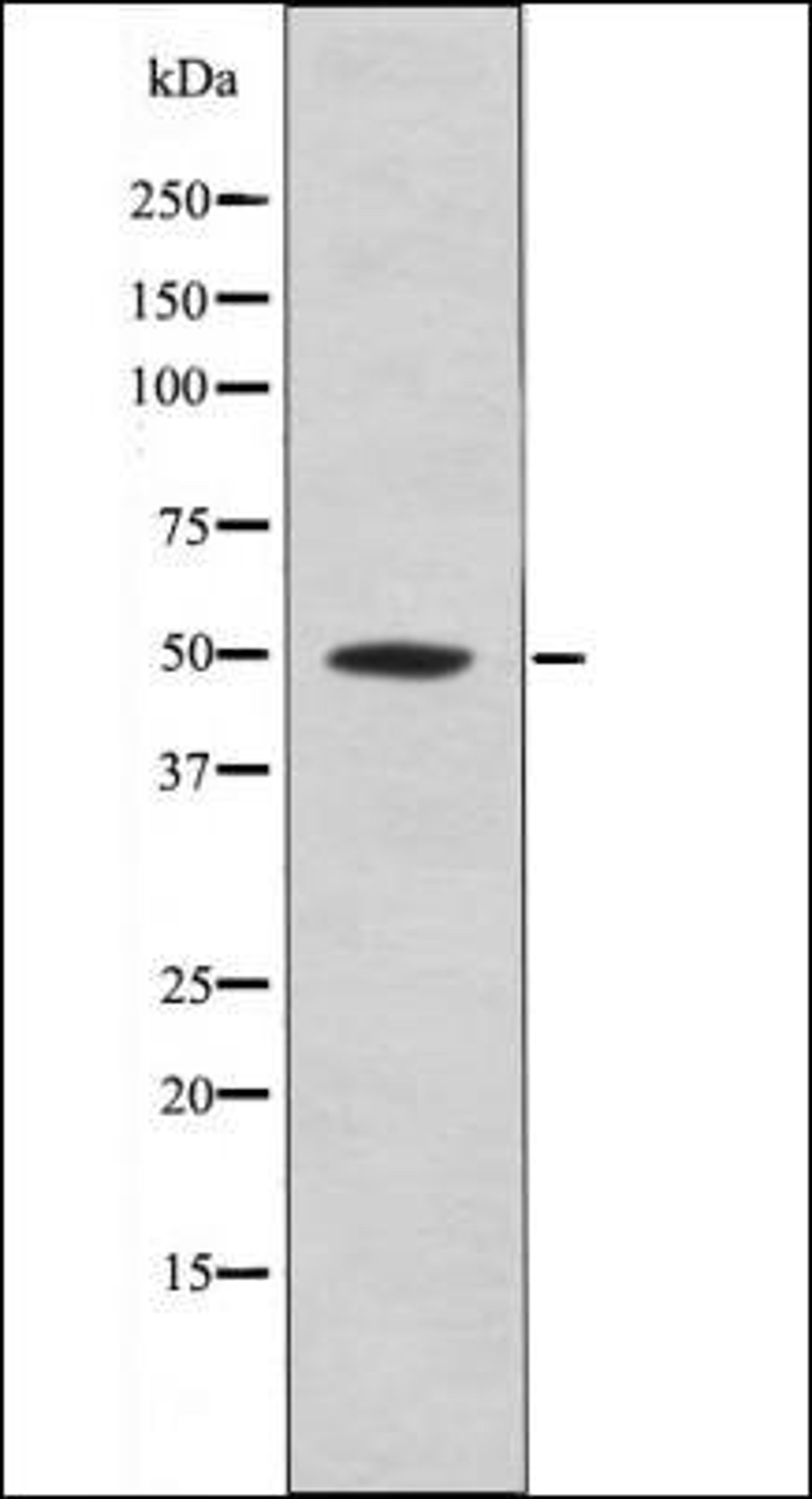 Western blot analysis of Mouse braintissue lysates using MOK -Phospho-Tyr161- antibody