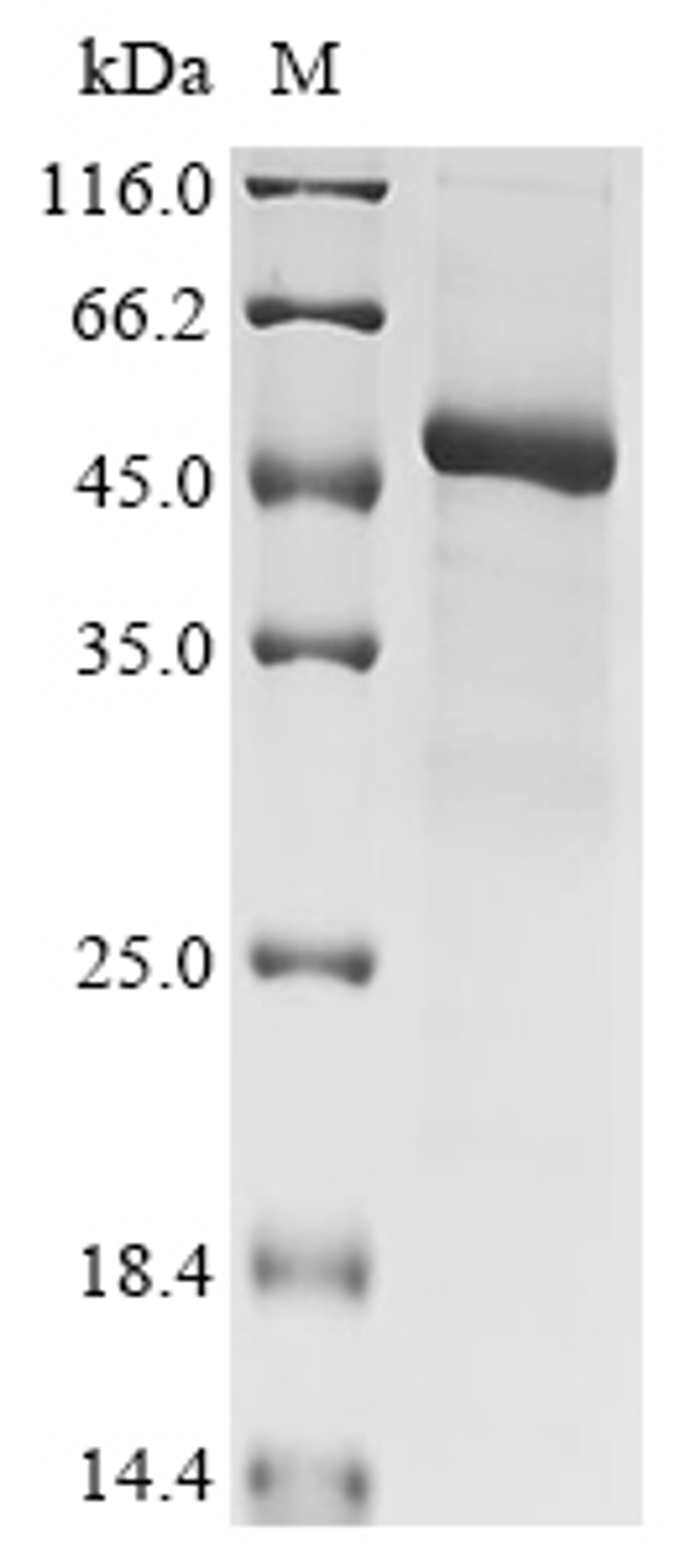 (Tris-Glycine gel) Discontinuous SDS-PAGE (reduced) with 5% enrichment gel and 15% separation gel.