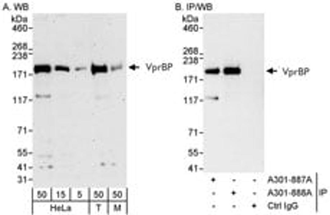 Detection of human and mouse VprBP by western blot (h&m) and immunoprecipitation (h).