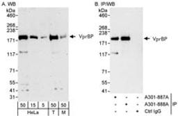 Detection of human and mouse VprBP by western blot (h&m) and immunoprecipitation (h).