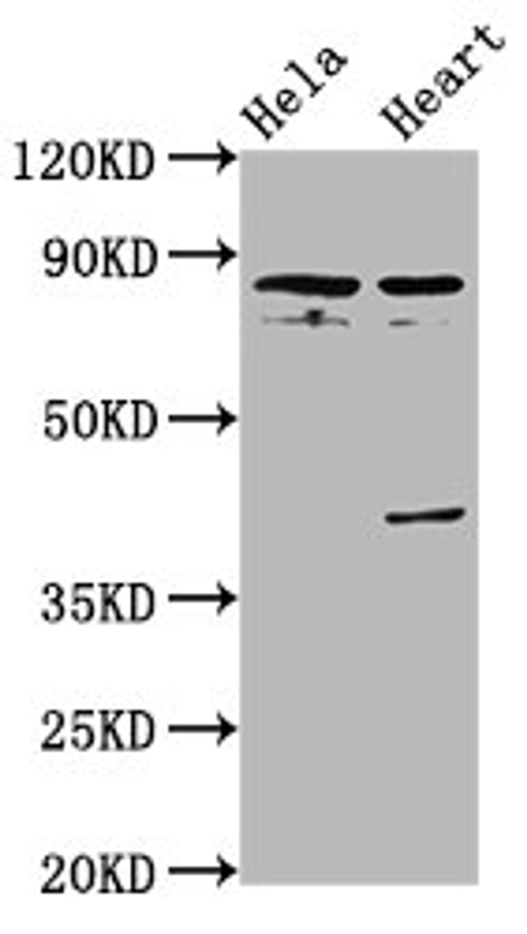 Western Blot. Positive WB detected in: Hela whole cell lysate, Rat heart tissue. All lanes: QSOX1 antibody at 5.6ug/ml. Secondary. Goat polyclonal to rabbit IgG at 1/50000 dilution. Predicted band size: 83 kDa. Observed band size: 83 kDa. 