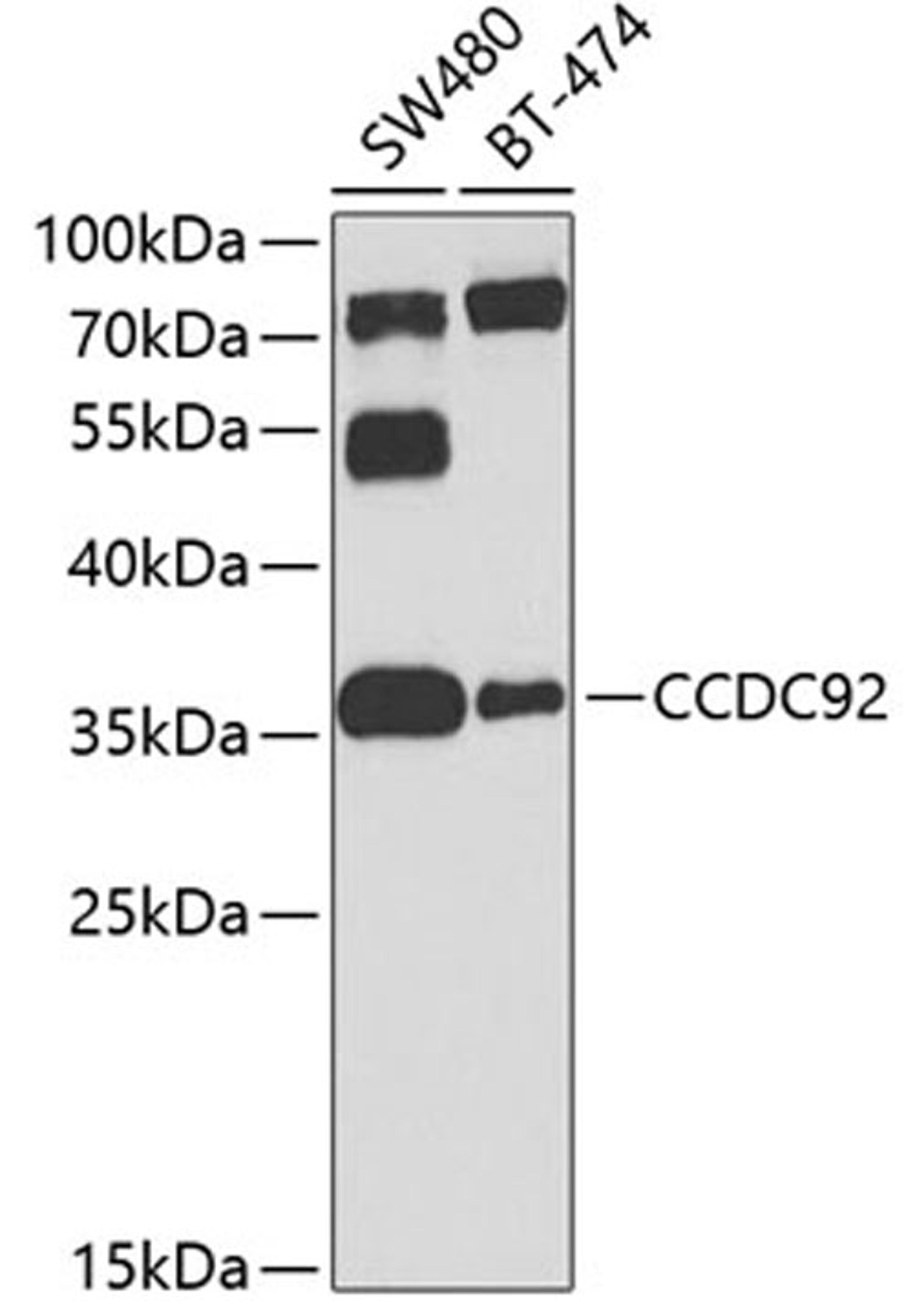 Western blot - CCDC92 antibody (A8262)