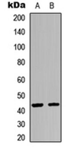 Western blot analysis of HEK293T (Lane 1), A549 (Lane 2) whole cell lysates using GPR54 antibody