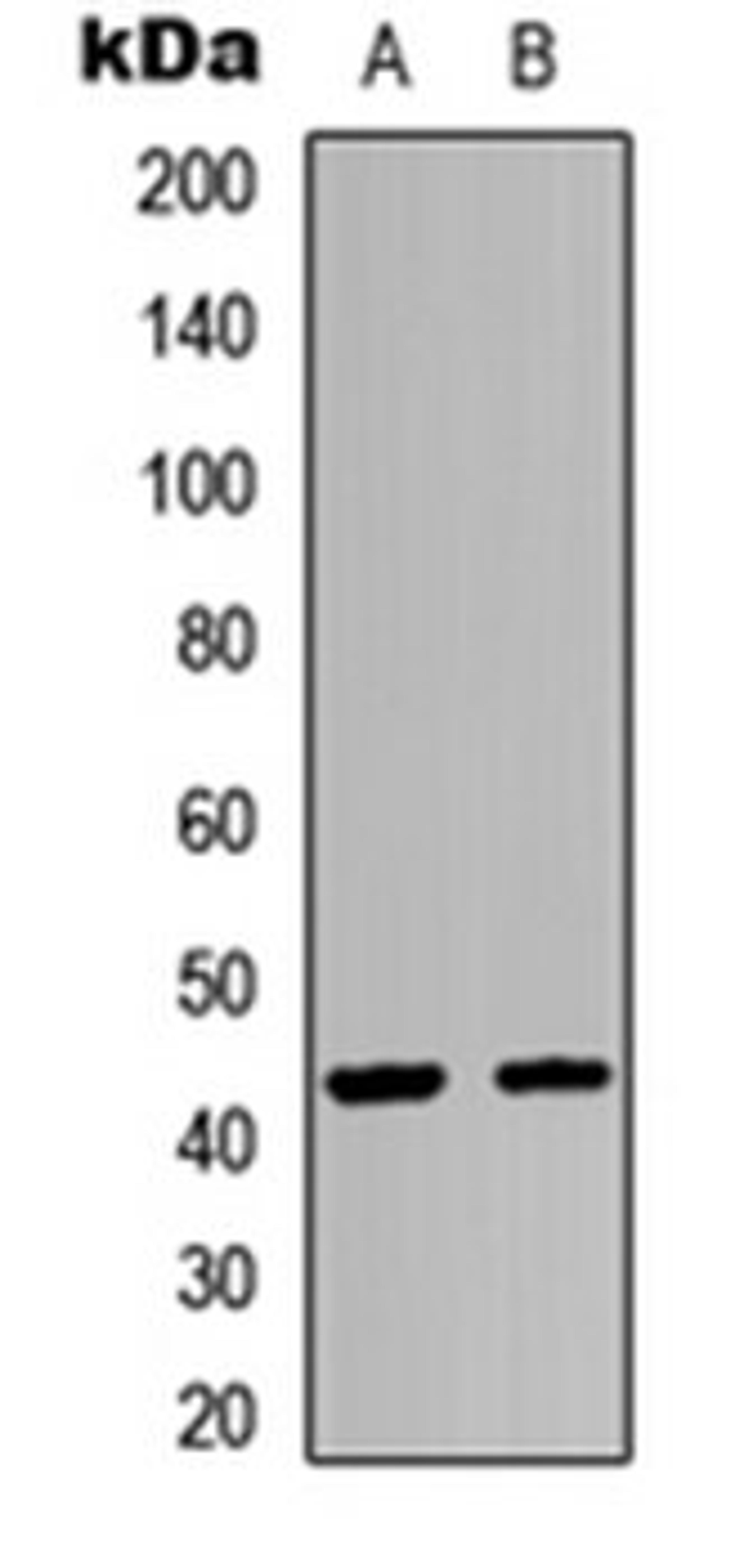 Western blot analysis of HEK293T (Lane 1), A549 (Lane 2) whole cell lysates using GPR54 antibody