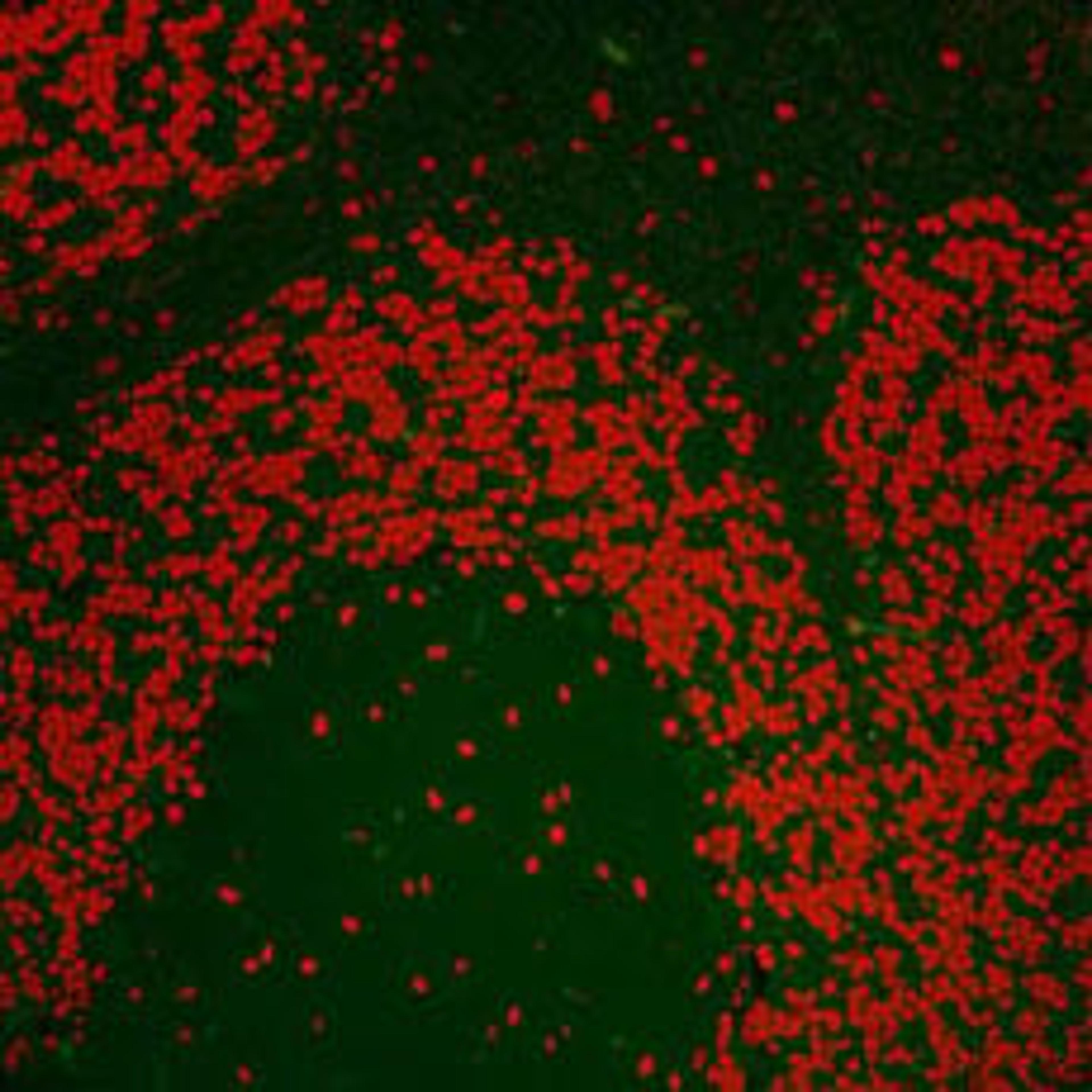 Detection of mouse Nucleolin by immunohistochemistry.