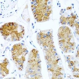 Immunohistochemical staining of rat lung tissue using C8orf4 antibody (dilution of 1:100)