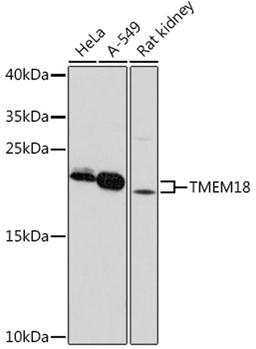 Western blot - TMEM18 pAb (A18541)