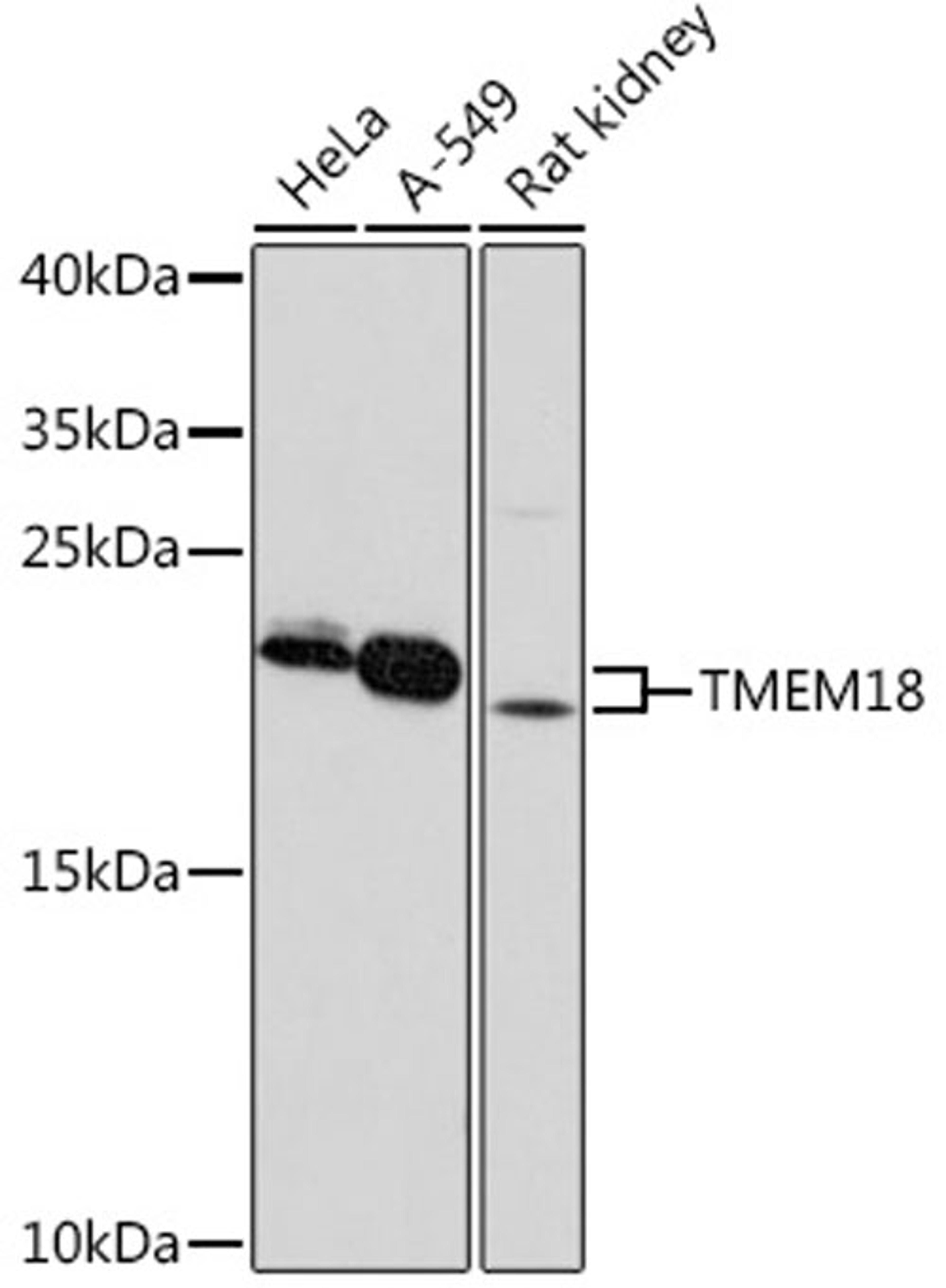 Western blot - TMEM18 pAb (A18541)