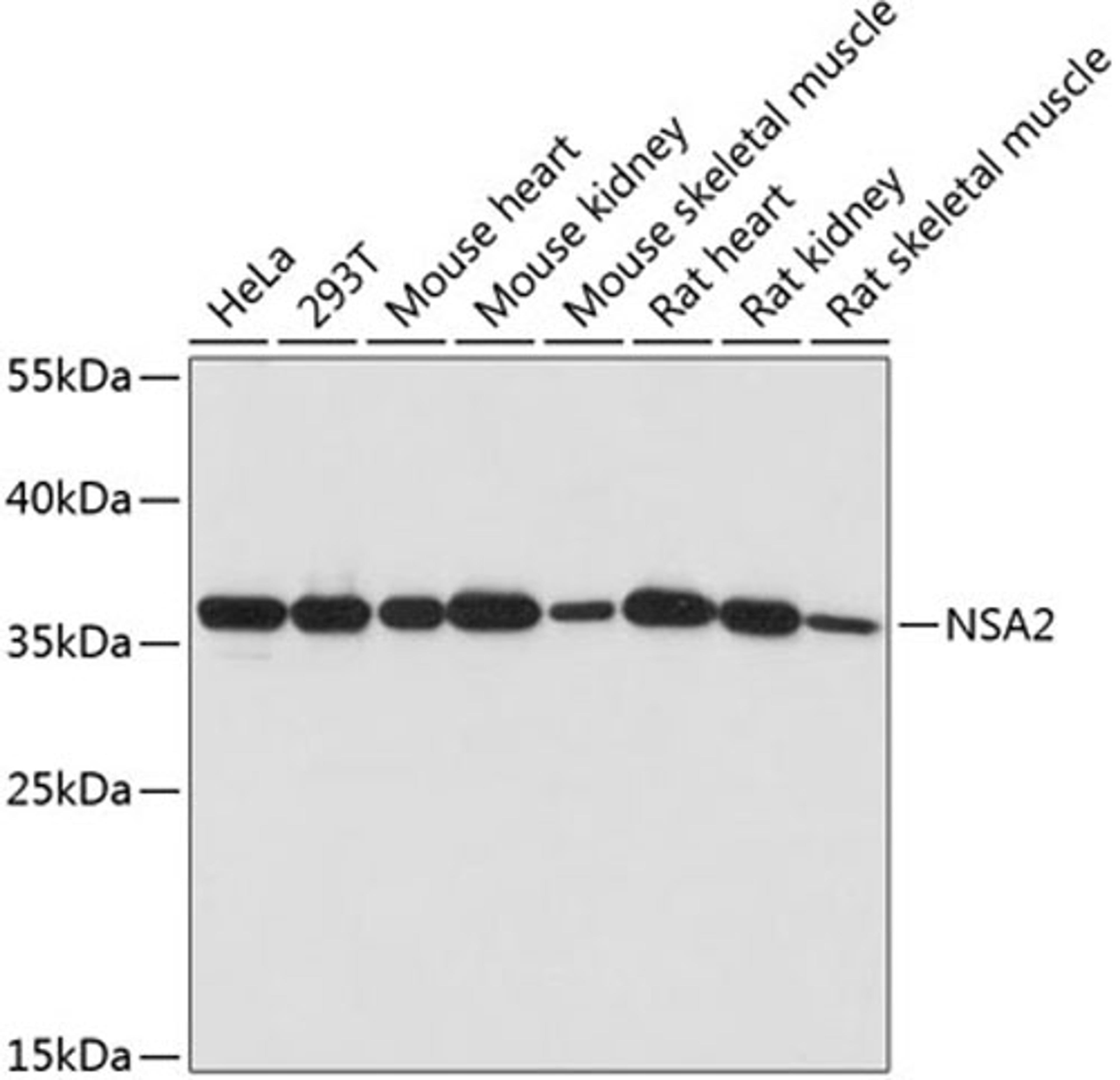 Western blot - NSA2 antibody (A14475)