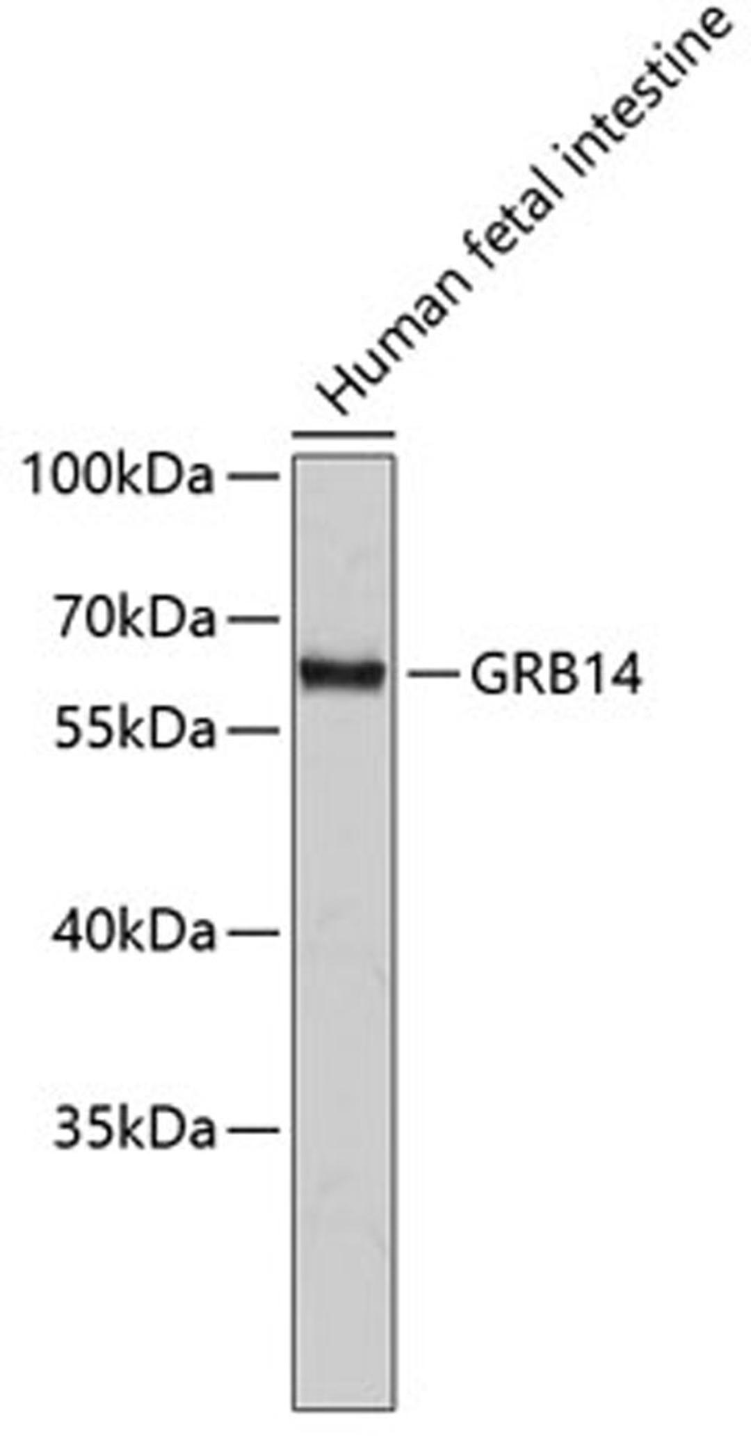 Western blot - GRB14 antibody (A2742)