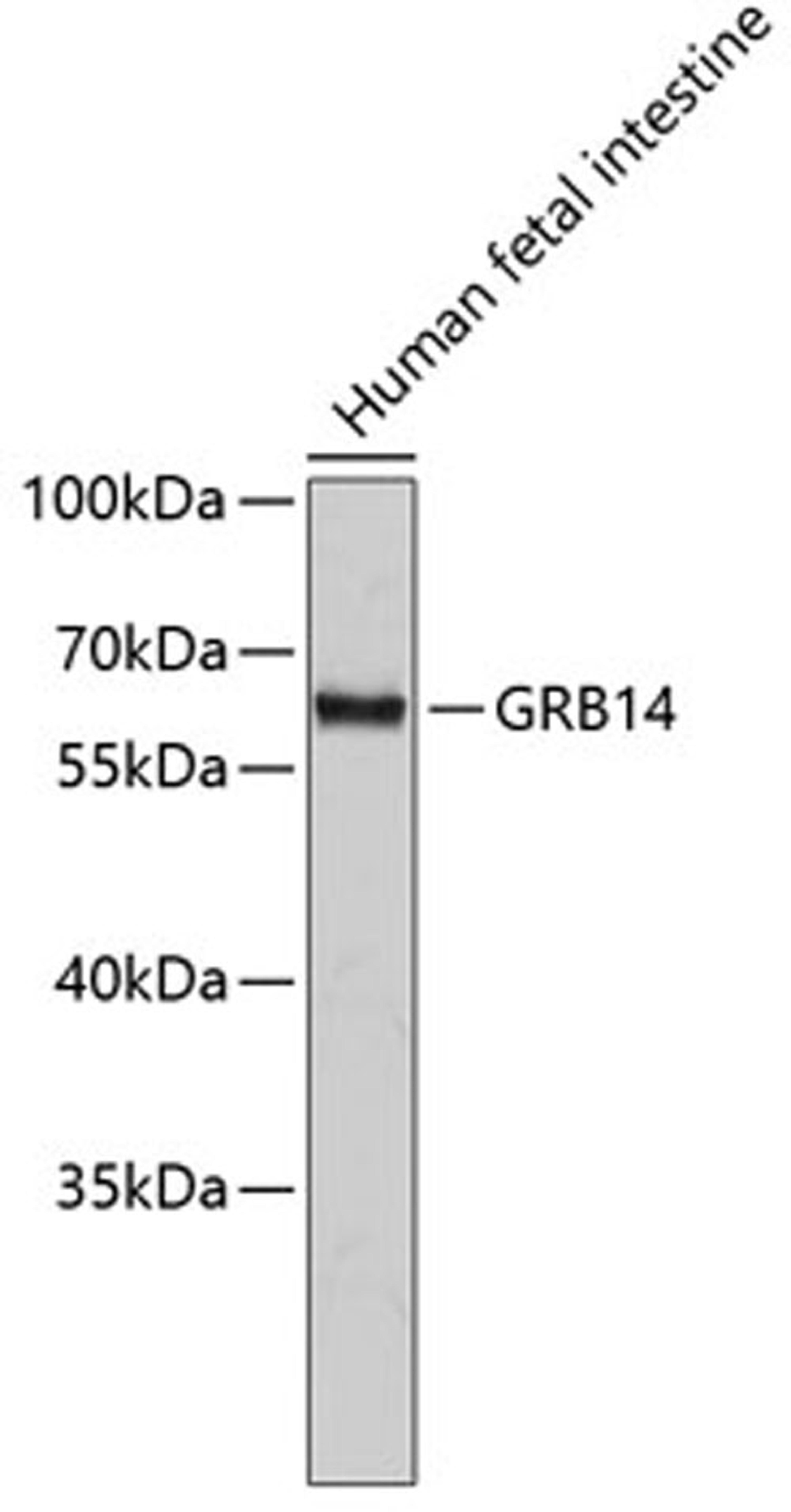 Western blot - GRB14 antibody (A2742)