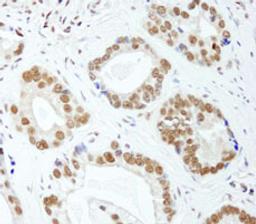 Detection of human E1B-AP5 by immunohistochemistry.