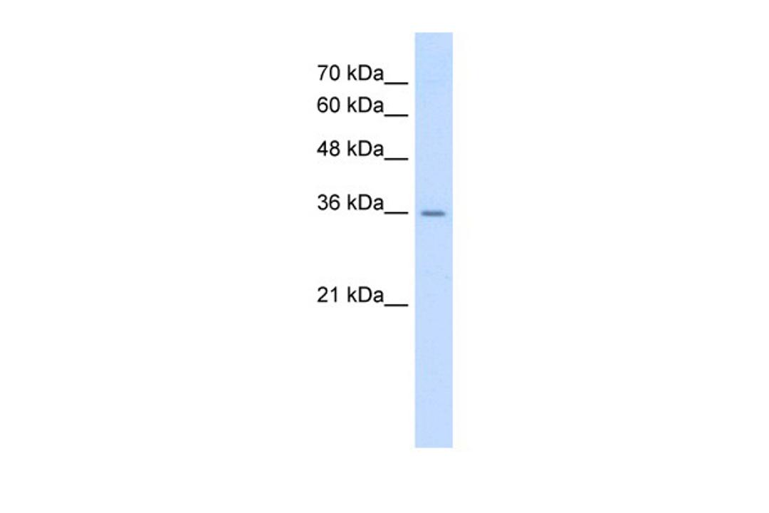 Antibody used in WB on Human HepG2 at 0.2-1 ug/ml.