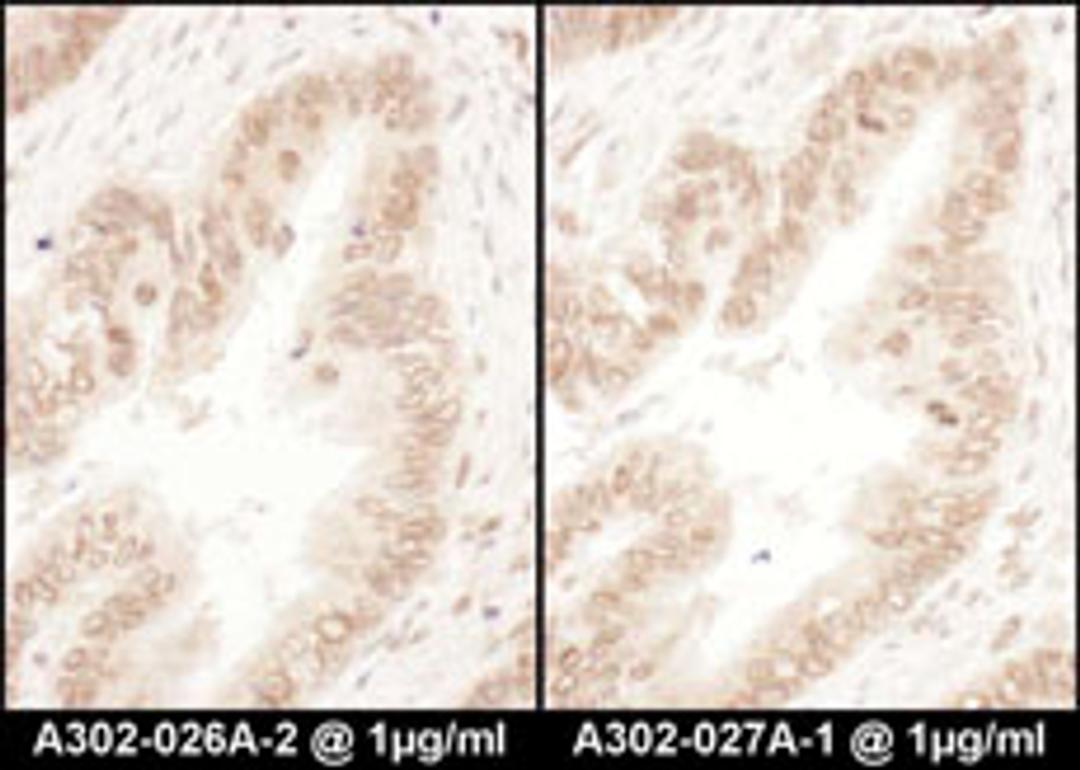 Detection of human RanGAP1 by immunohistochemistry.