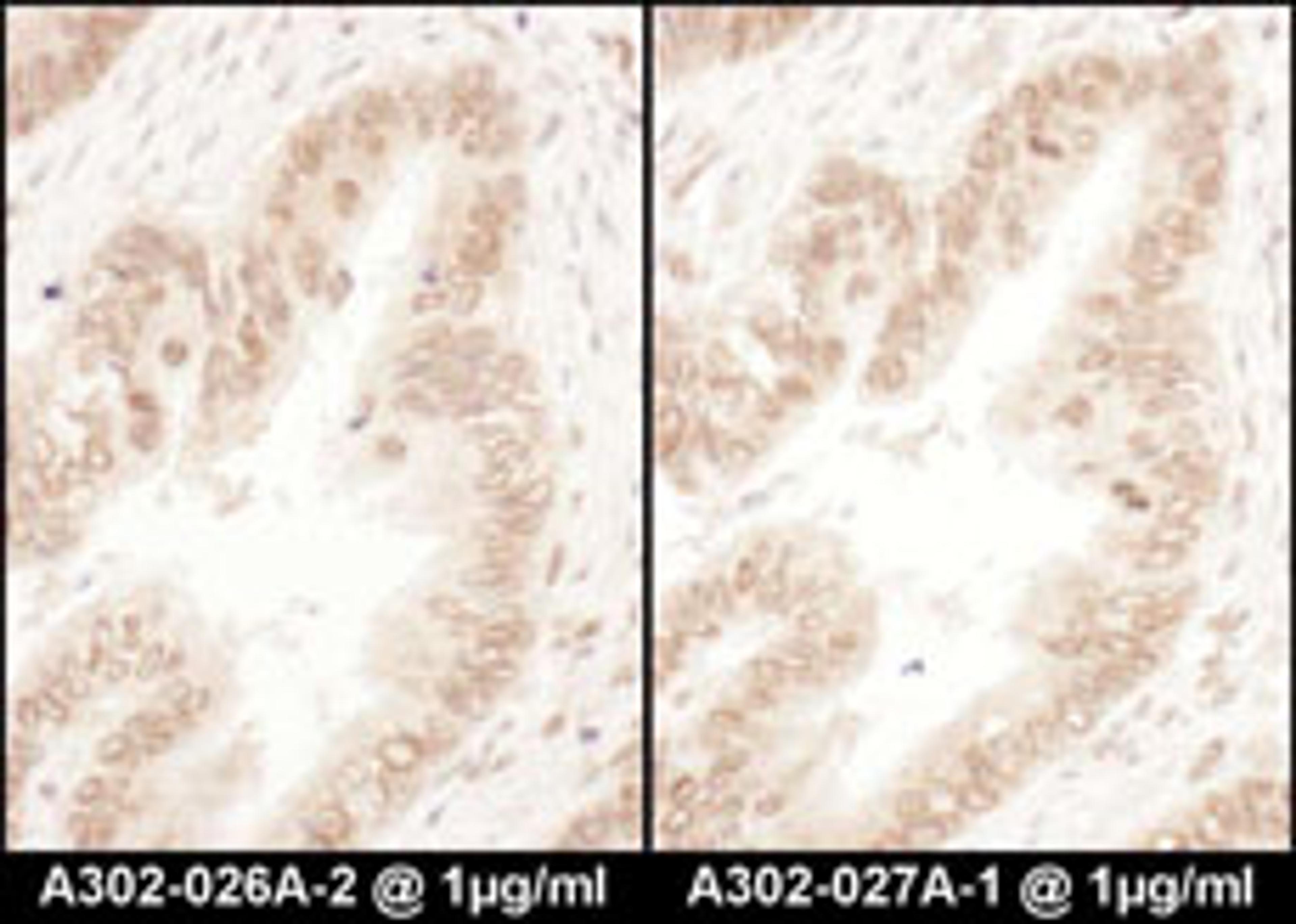 Detection of human RanGAP1 by immunohistochemistry.