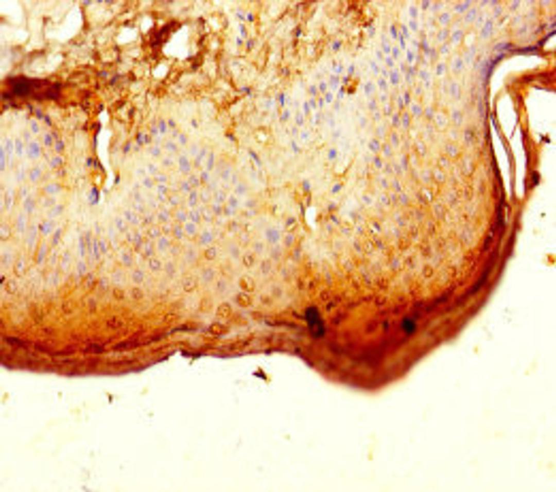 Immunohistochemistry of paraffin-embedded human skin tissue using CSB-PA887130LA01HU at dilution of 1:100