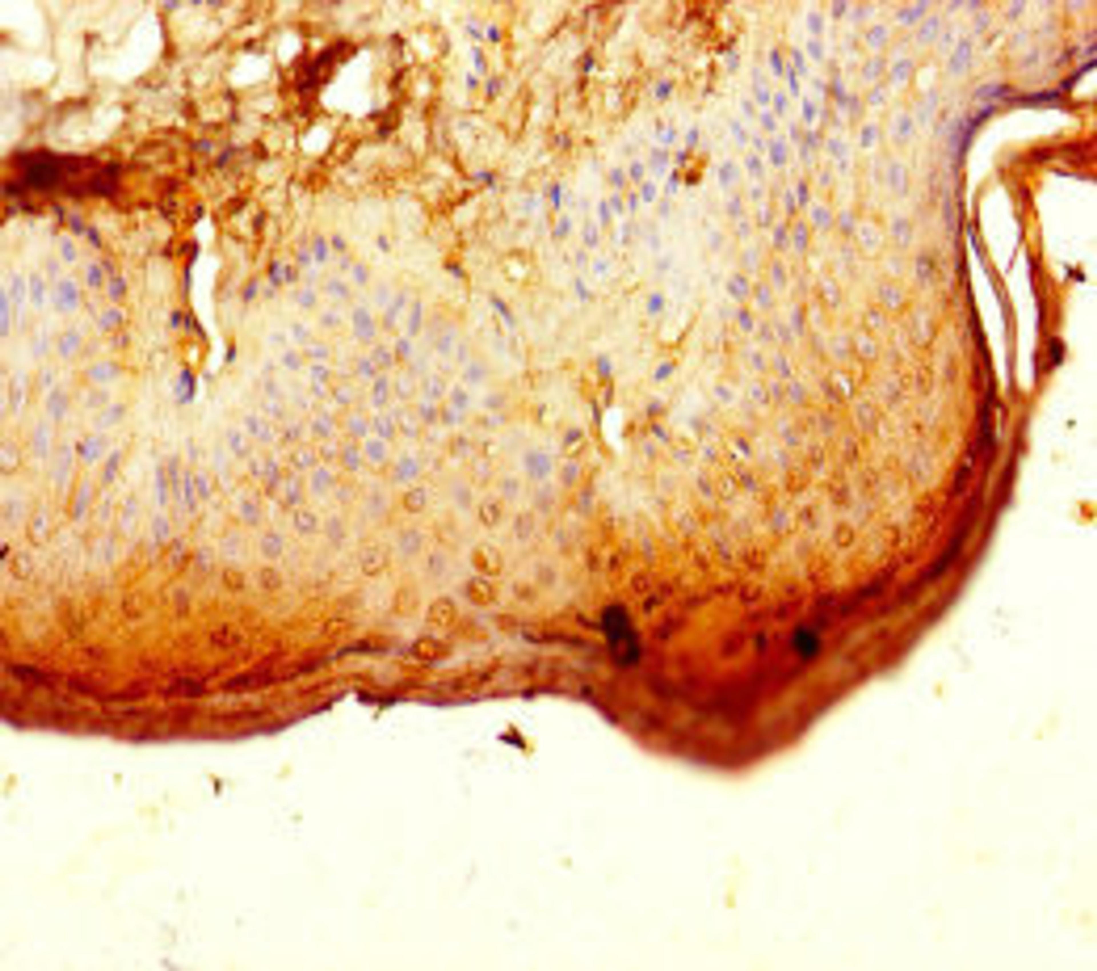 Immunohistochemistry of paraffin-embedded human skin tissue using CSB-PA887130LA01HU at dilution of 1:100