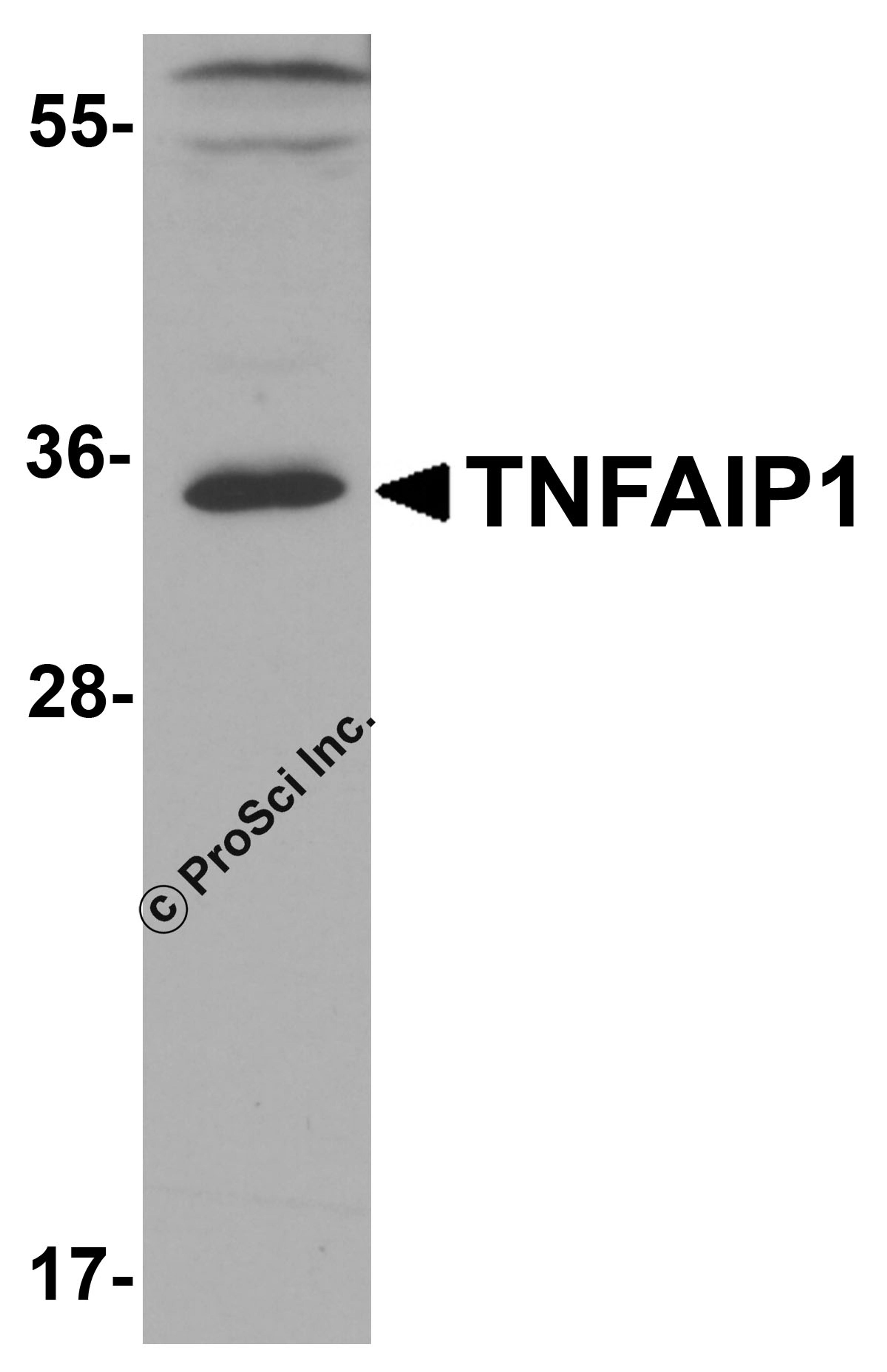 Western blot analysis of TNFAIP1 in mouse brain tissue lysate with TNFAIP1 antibody at 1 &#956;g/ml.