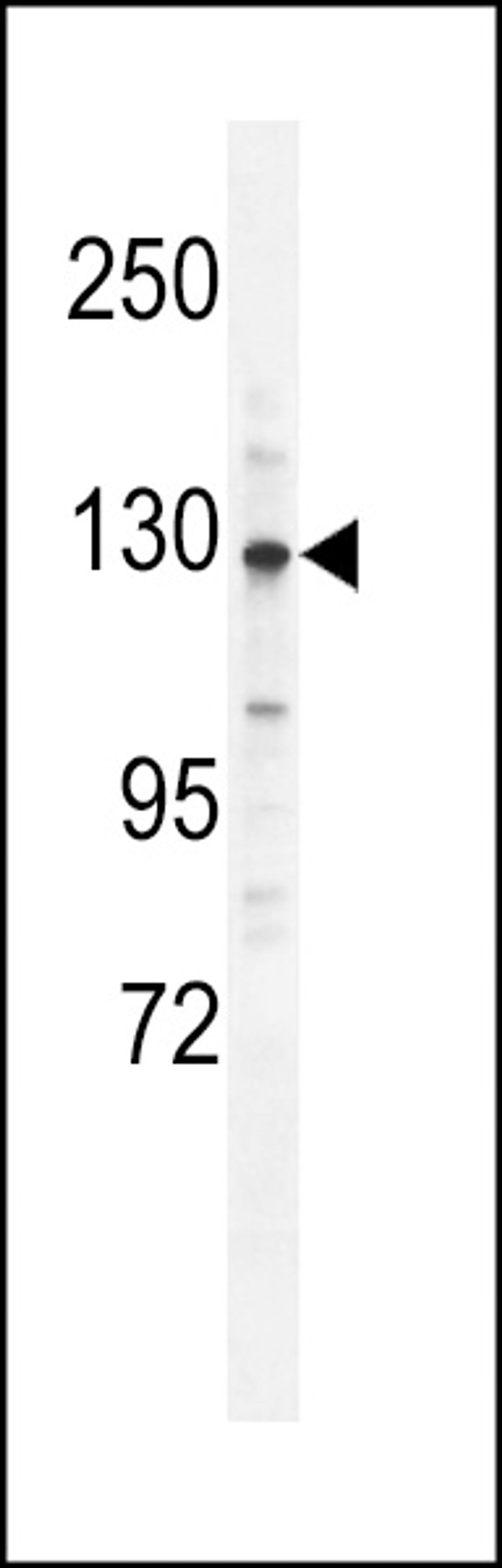 Western blot analysis in mouse brain tissue lysates (35ug/lane).