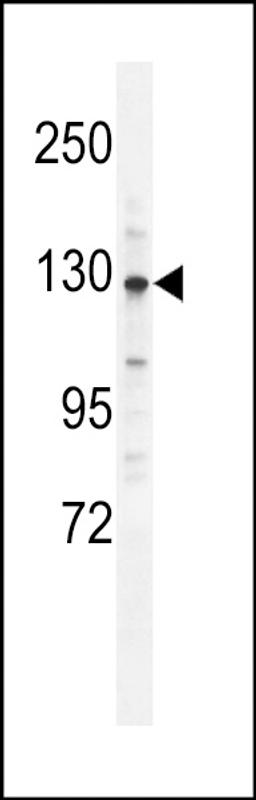 Western blot analysis in mouse brain tissue lysates (35ug/lane).