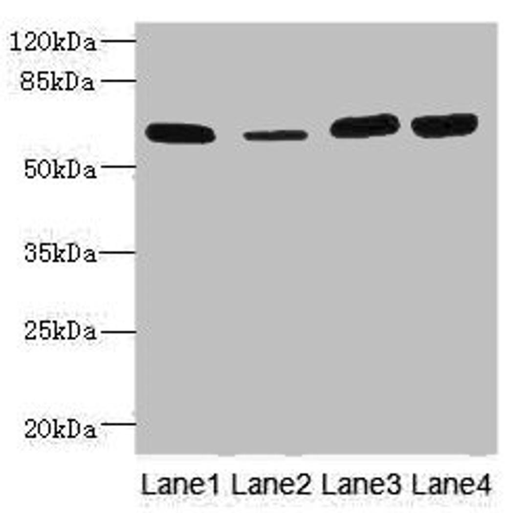Western blot. All lanes: THBD antibody at 3.07µg/ml. Lane 1: Rat heart tissue. Lane 2: Mouse kidney tissue. Lane 3: A549 whole cell lysate. Lane 4: A431 whole cell lysate. Secondary. Goat polyclonal to rabbit IgG at 1/10000 dilution. Predicted band size: 60 kDa. Observed band size: 60 kDa