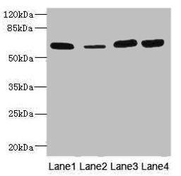 Western blot. All lanes: THBD antibody at 3.07µg/ml. Lane 1: Rat heart tissue. Lane 2: Mouse kidney tissue. Lane 3: A549 whole cell lysate. Lane 4: A431 whole cell lysate. Secondary. Goat polyclonal to rabbit IgG at 1/10000 dilution. Predicted band size: 60 kDa. Observed band size: 60 kDa