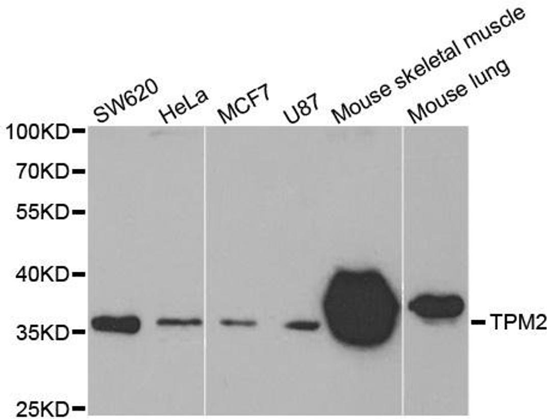 Western blot analysis of extracts of various cell lines using TPM2 antibody