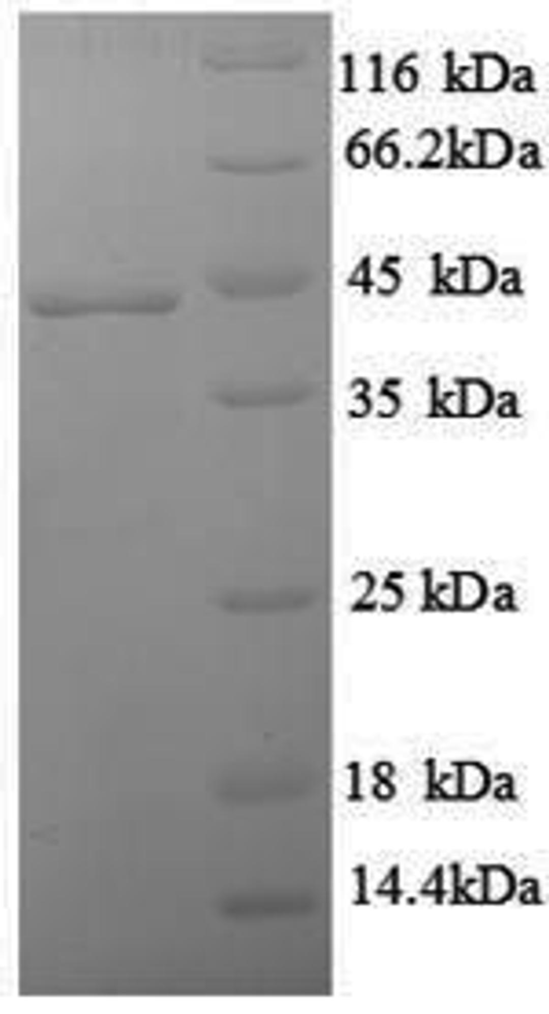 (Tris-Glycine gel) Discontinuous SDS-PAGE (reduced) with 5% enrichment gel and 15% separation gel.