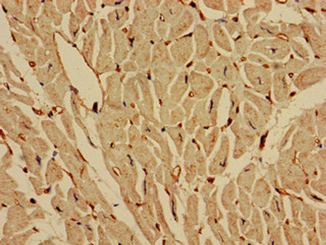 Immunohistochemistry of paraffin-embedded human heart tissue using CSB-PA011813LA01HU at dilution of 1:100