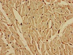 Immunohistochemistry of paraffin-embedded human heart tissue using CSB-PA011813LA01HU at dilution of 1:100