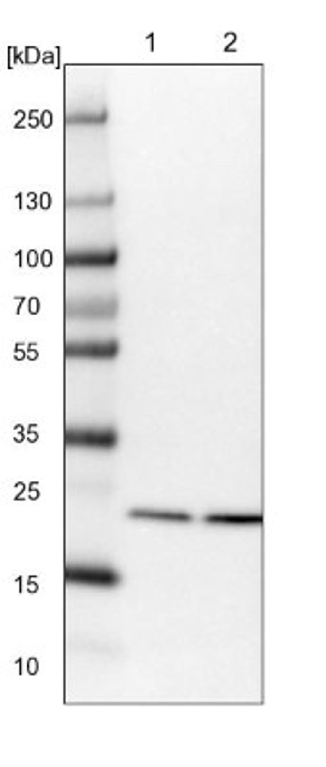 Western Blot: Proteasome 20S beta2 Antibody [NBP1-92294] - Lane 1: NIH-3T3 cell lysate (Mouse embryonic fibroblast cells)<br/>Lane 2: NBT-II cell lysate (Rat Wistar bladder tumour cells)