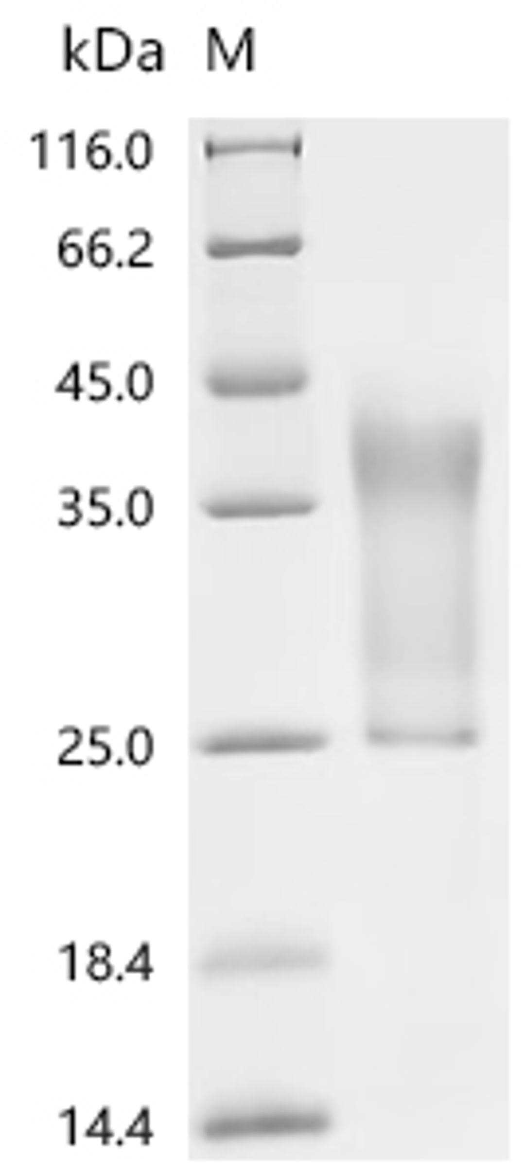 (Tris-Glycine gel) Discontinuous SDS-PAGE (reduced) with 5% enrichment gel and 15% separation gel.