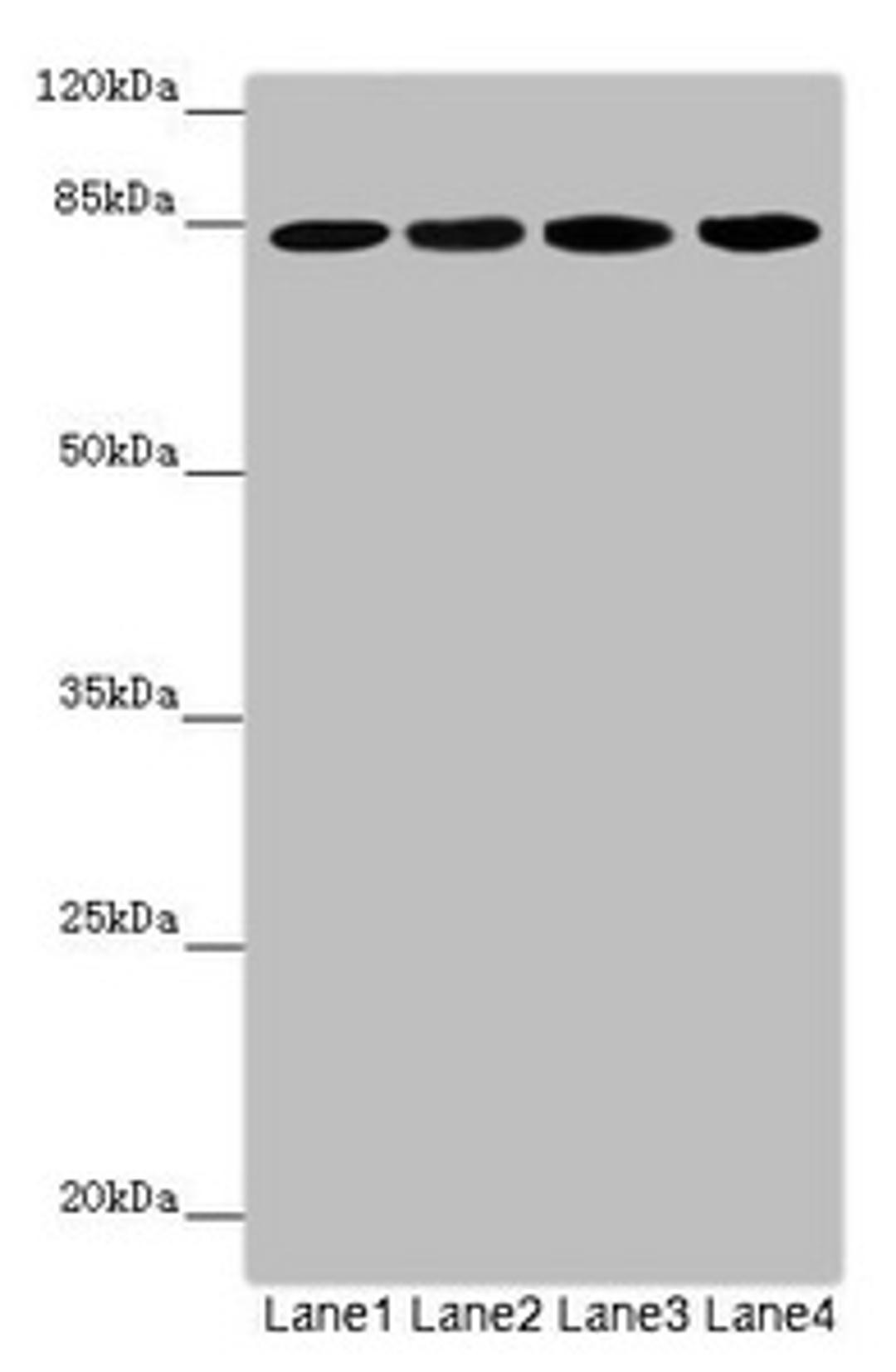 Western blot. All lanes: LRSAM1 antibody at 2.57µg/ml. Lane 1: Mouse brain tissue. Lane 2: Jurkat whole cell lysate. Lane 3: Hela whole cell lysate. Lane 4: 293T whole cell lysate. Secondary. Goat polyclonal to rabbit IgG at 1/10000 dilution. Predicted band size: 84, 81, 36 kDa. Observed band size: 84 kDa