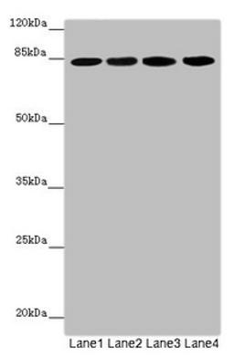 Western blot. All lanes: LRSAM1 antibody at 2.57µg/ml. Lane 1: Mouse brain tissue. Lane 2: Jurkat whole cell lysate. Lane 3: Hela whole cell lysate. Lane 4: 293T whole cell lysate. Secondary. Goat polyclonal to rabbit IgG at 1/10000 dilution. Predicted band size: 84, 81, 36 kDa. Observed band size: 84 kDa