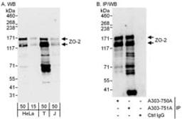 Detection of human ZO-2 by western blot and immunoprecipitation.