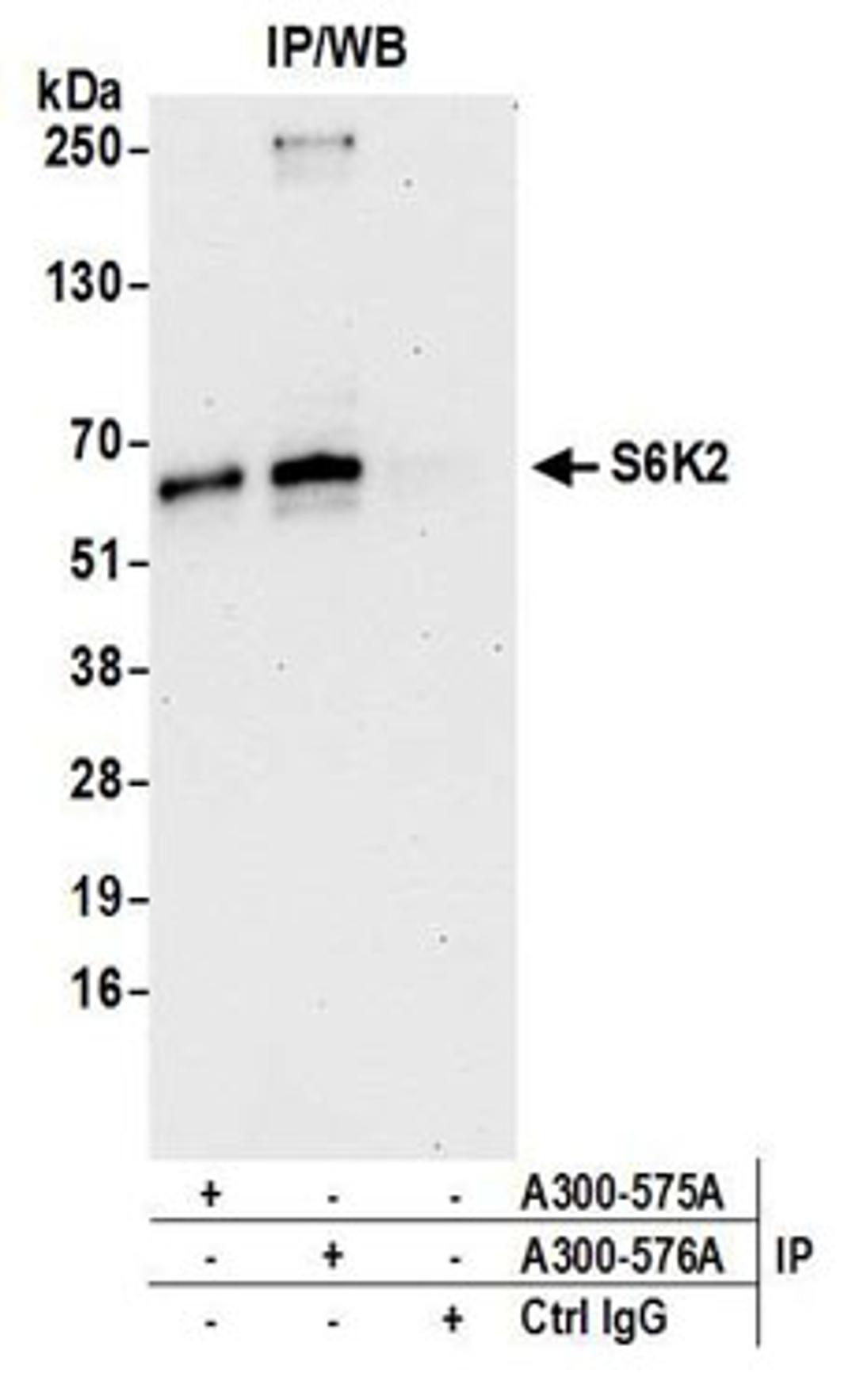 Detection of human S6K2 by western blot of immunoprecipitates.