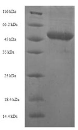 (Tris-Glycine gel) Discontinuous SDS-PAGE (reduced) with 5% enrichment gel and 15% separation gel.
