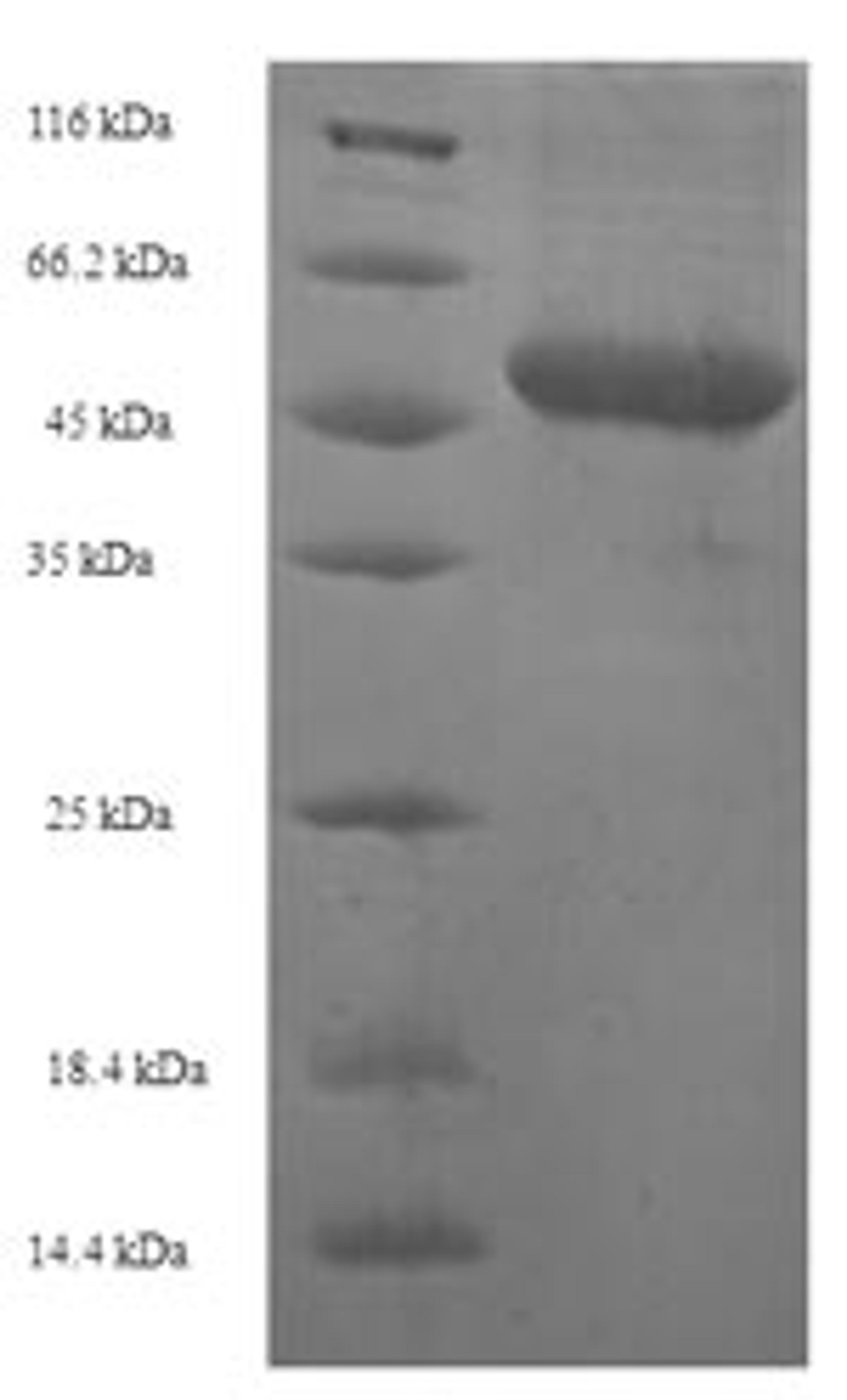 (Tris-Glycine gel) Discontinuous SDS-PAGE (reduced) with 5% enrichment gel and 15% separation gel.