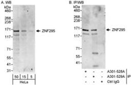 Detection of human ZNF295 by western blot and immunoprecipitation.