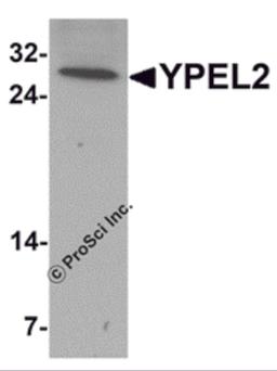 Western blot analysis of YPEL2 in HeLa cell lysate with YPEL2 antibody at 1 μg/mL.