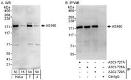 Detection of human AS160 by western blot and immunoprecipitation.