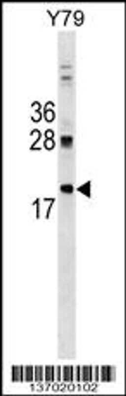 Western blot analysis in Y79 cell line lysates (35ug/lane).