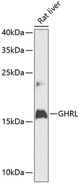 Western blot - GHRL antibody (A12581)