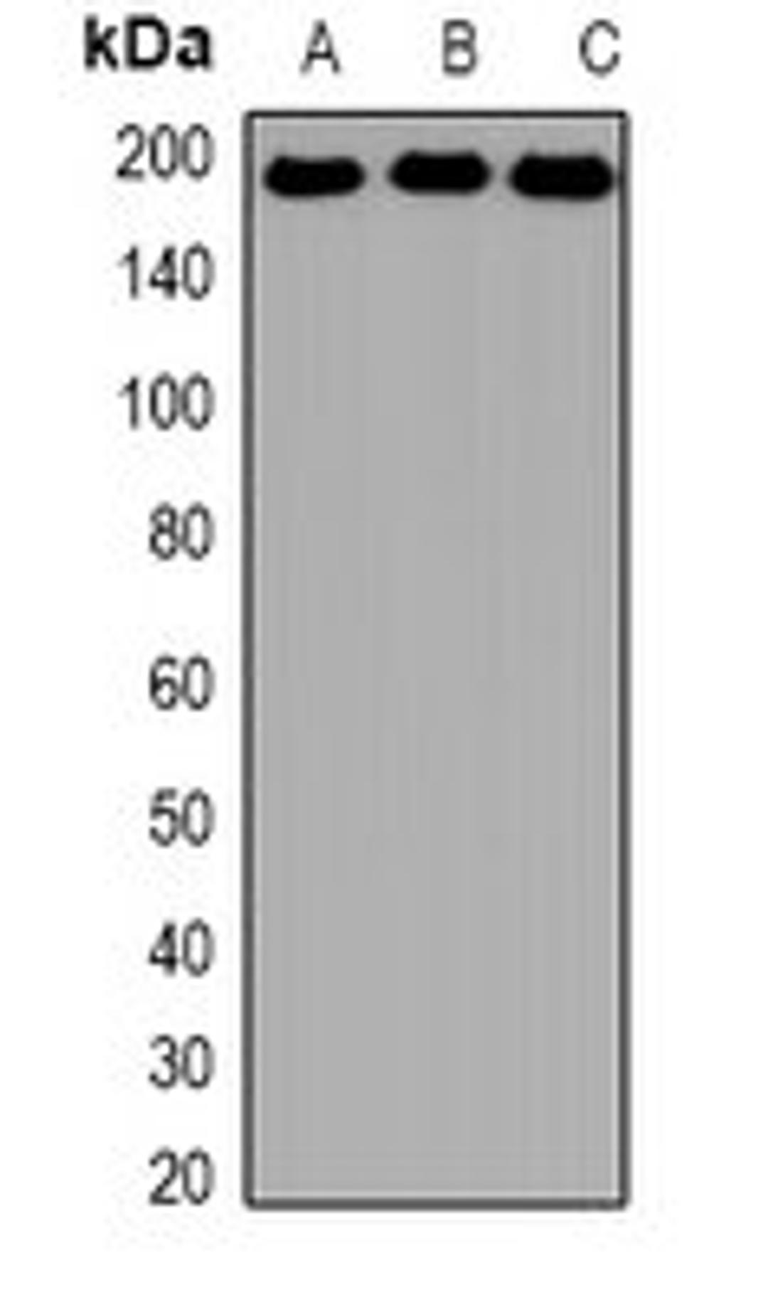 Western blot analysis of Hela (Lane1), K562 (Lane2), NIH3T3 (Lane3) whole cell lysates using SMARCA4 antibody