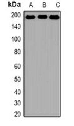 Western blot analysis of Hela (Lane1), K562 (Lane2), NIH3T3 (Lane3) whole cell lysates using SMARCA4 antibody