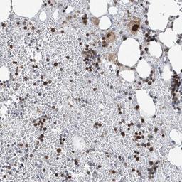 Immunohistochemistry-Paraffin: PAPSS1 Antibody [NBP2-13730] - Staining of human bone marrow shows strong nuclear positivity in hematopoietic cells.