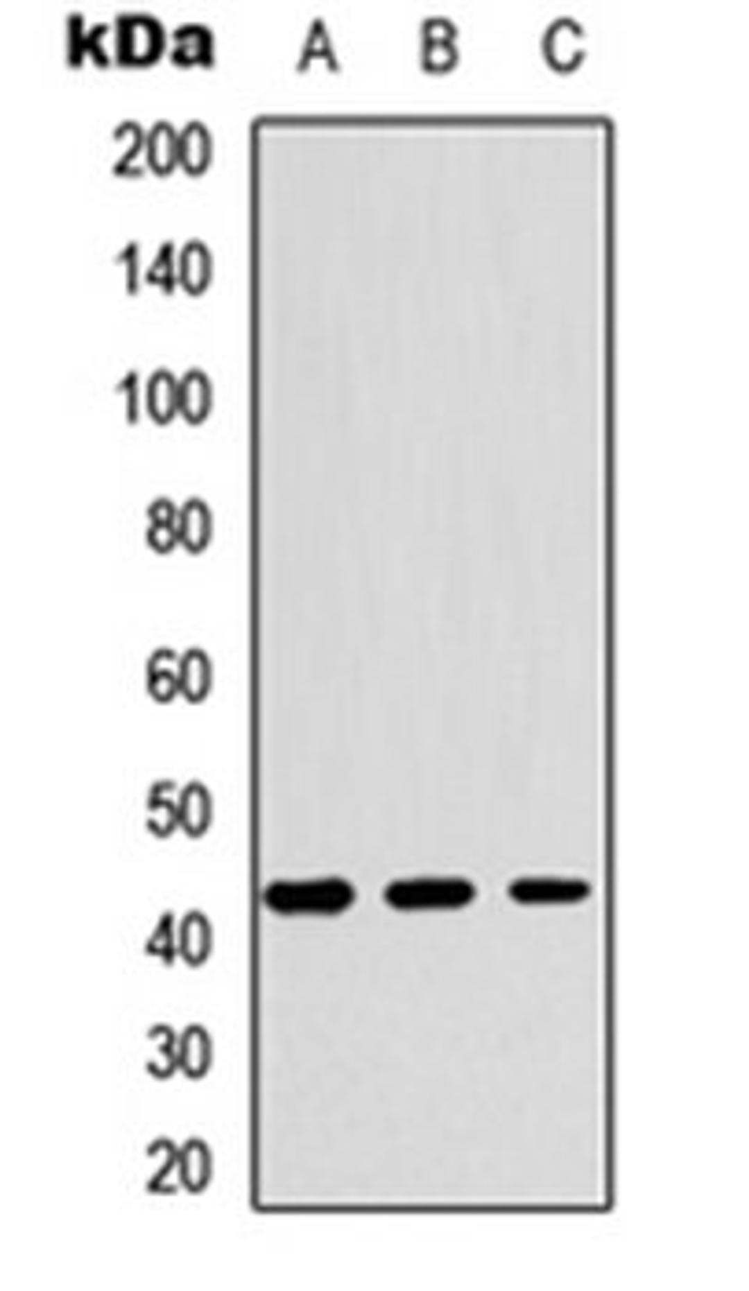 Western blot analysis of HEK293T (Lane 1), Raw264.7 (Lane 2), H9C2 (Lane 3) whole cell lysates using YKL-40 antibody