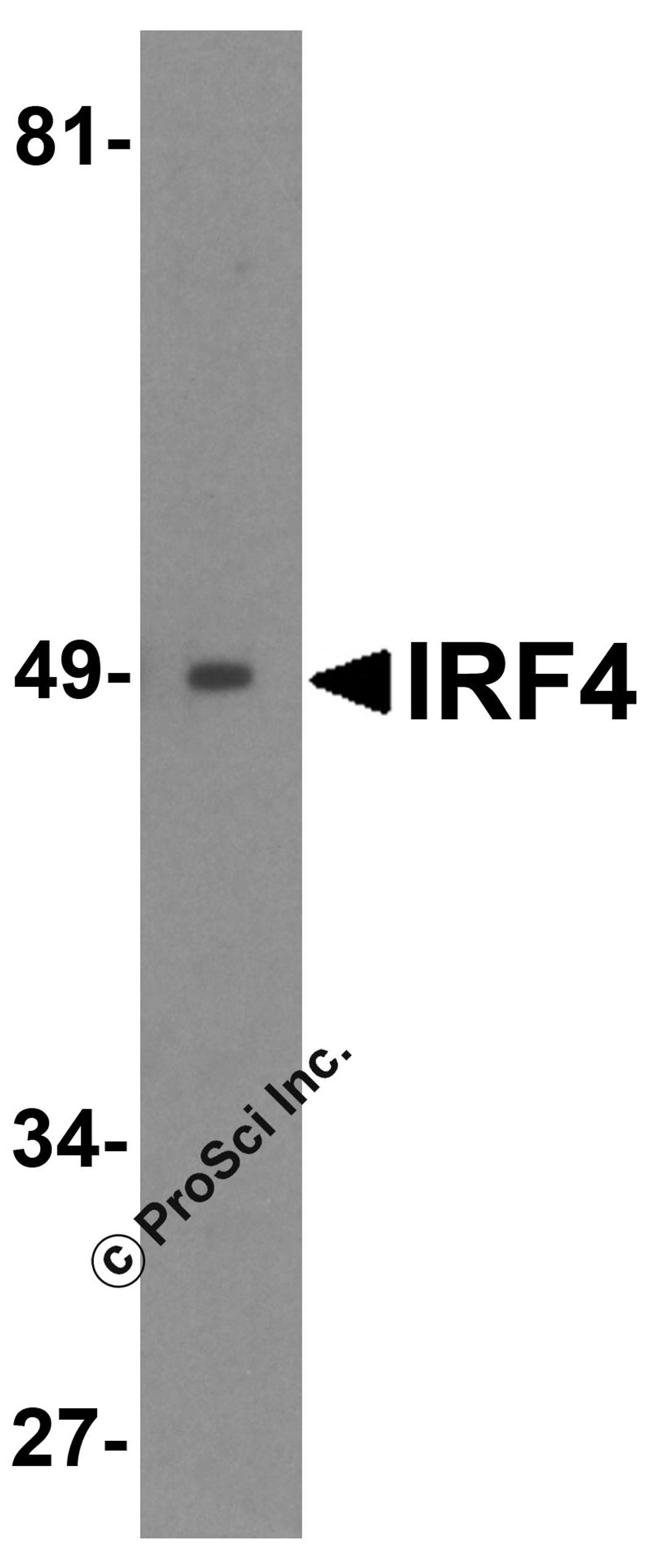 Western blot analysis of IRF4 in Ramos cell lysate with IRF4 antibody at 0.5 &#956;g/mL.